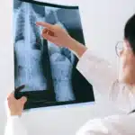 Médico analisando radiografia da coluna vertebral, segurando a chapa de raio-X com as mãos e apontando para a região lombar.