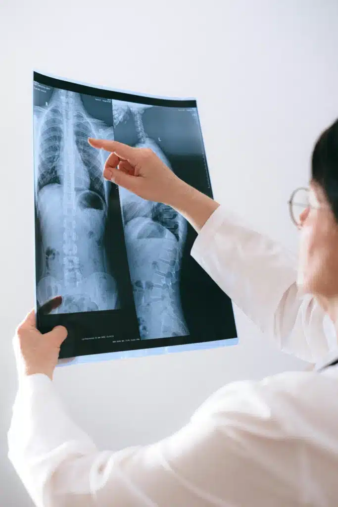Médico analisando radiografia da coluna vertebral, segurando a chapa de raio-X com as mãos e apontando para a região lombar.